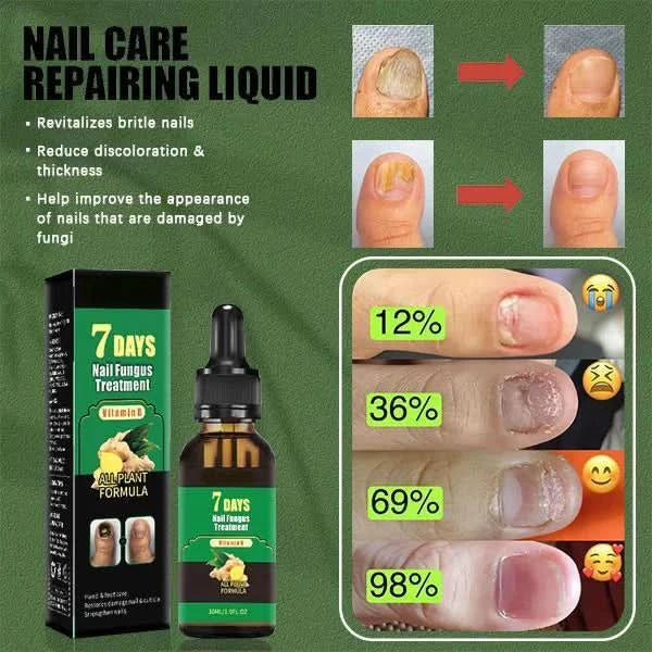 Körömkezelés – Természetes gombaellenes ápolás 